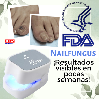 NAILFUNGUS - LÁSER PARA UÑAS DE PIES Y MANOS