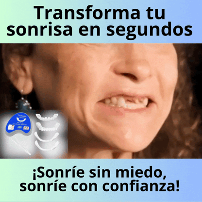 PerfectSmile® – Carillas Dentales Instantáneas - - Set 2 Pzs (Superior e inferior)