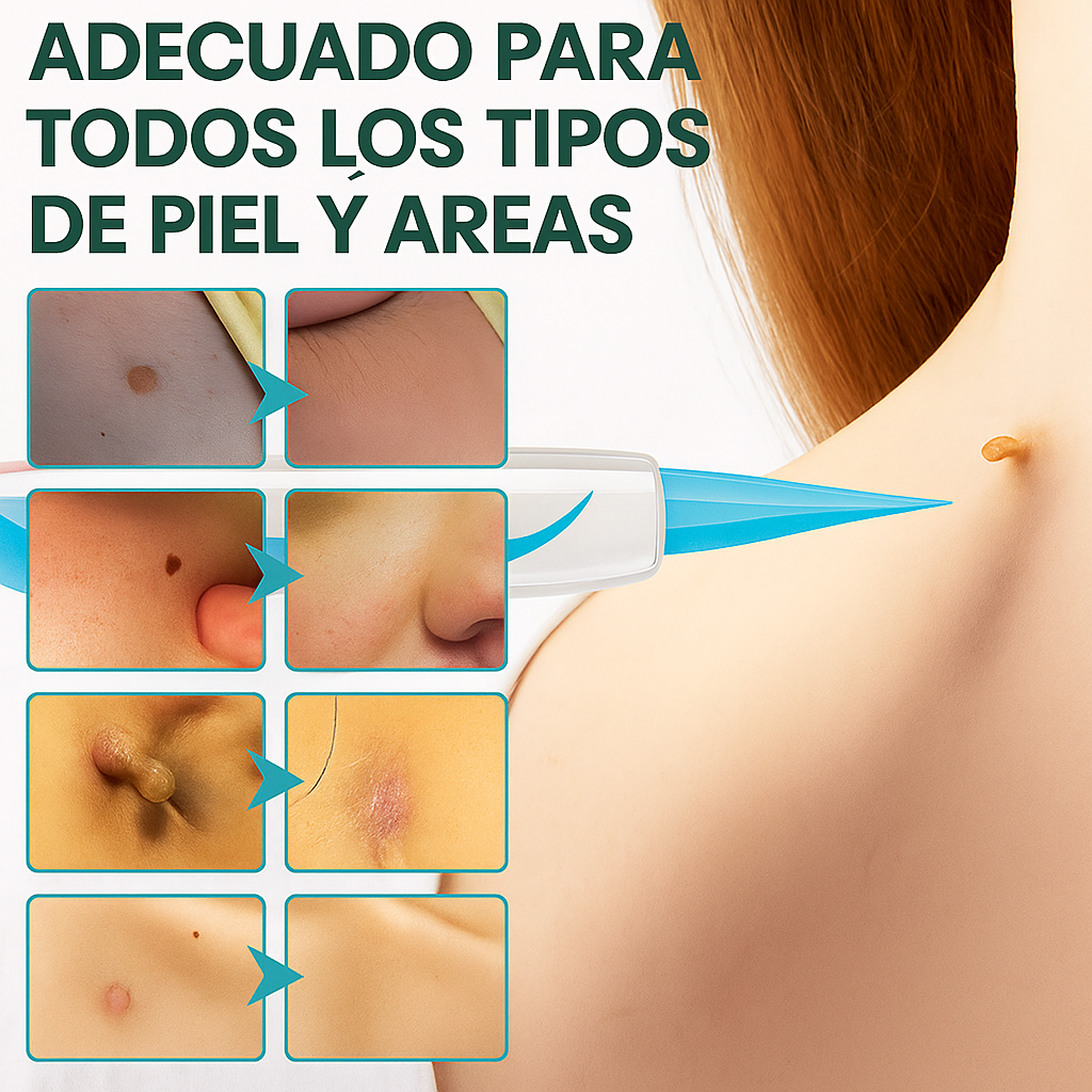 SkinOff Pro™ – Kit para la eliminación de verrugas y marcas en la piel