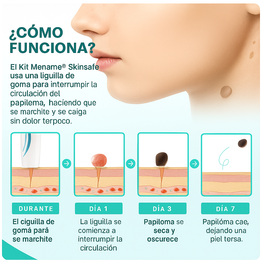 SkinOff Pro™ – Kit para la eliminación de verrugas y marcas en la piel
