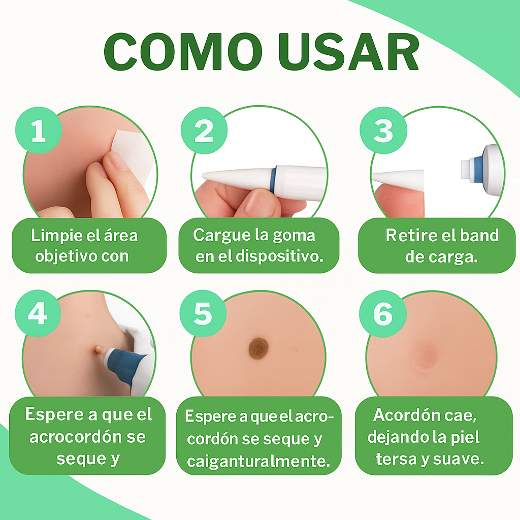 SkinOff Pro™ – Kit para la eliminación de verrugas y marcas en la piel