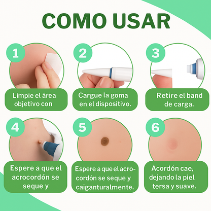 SkinOff Pro™ – Kit para la eliminación de verrugas y marcas en la piel