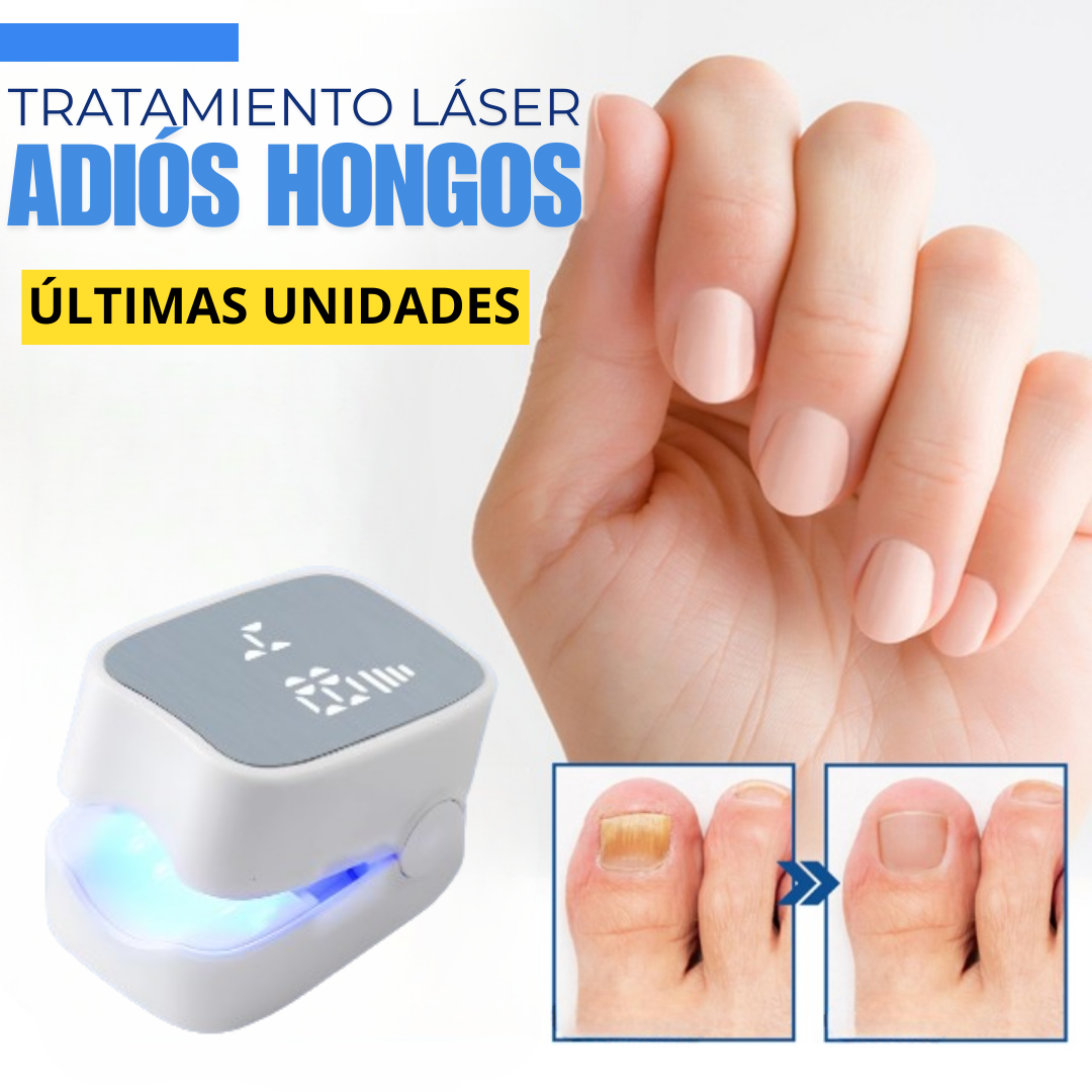 NAILFUNGUS - tratamiento láser de uso doméstico para hongos en las uñas