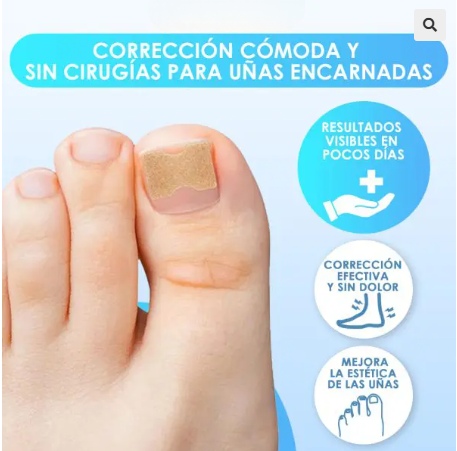 PARCHES PARA UÑAS ENTERRADAS
