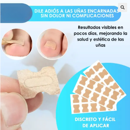 PARCHES PARA UÑAS ENTERRADAS