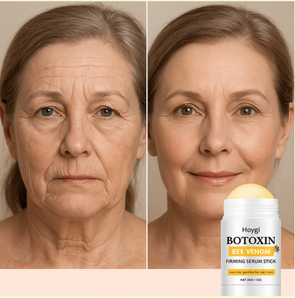 Crema antienvejecimiento con veneno de abeja