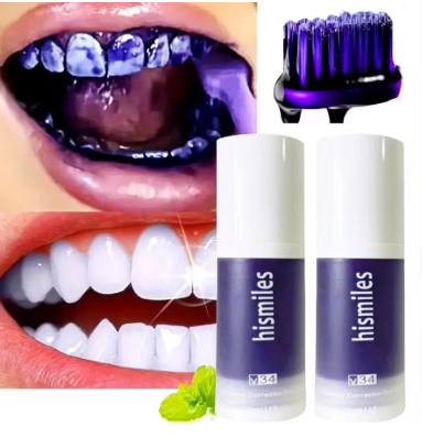 Blanqueador dental Sérum V34 – fórmula única y exclusiva para el blanqueamiento de los dientes en pocos minutos al día.