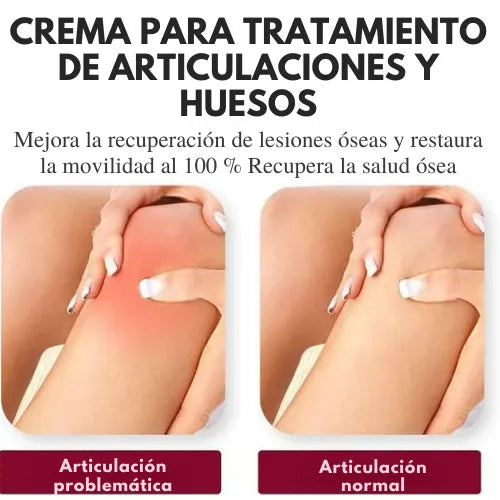 PerfectX™ Terapia Articular y Muscular | 🔥Compra 1 y lleva 1 GRATIS🔥
